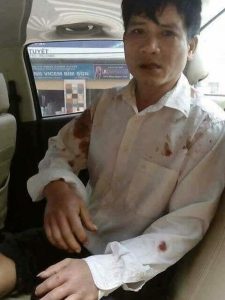 Pastor Nguyễn Trung Tôn after his attack (Photo Brotherhood for Democracy)
